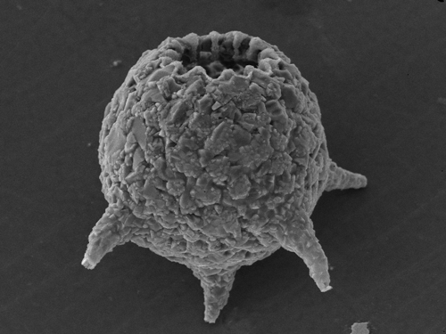 Mediolus corona, 2010, Scanning Electron Microscope, 150 microns, Yellowknife, Northwest Territories. Courtesy Patterson Research Group, Carleton University.